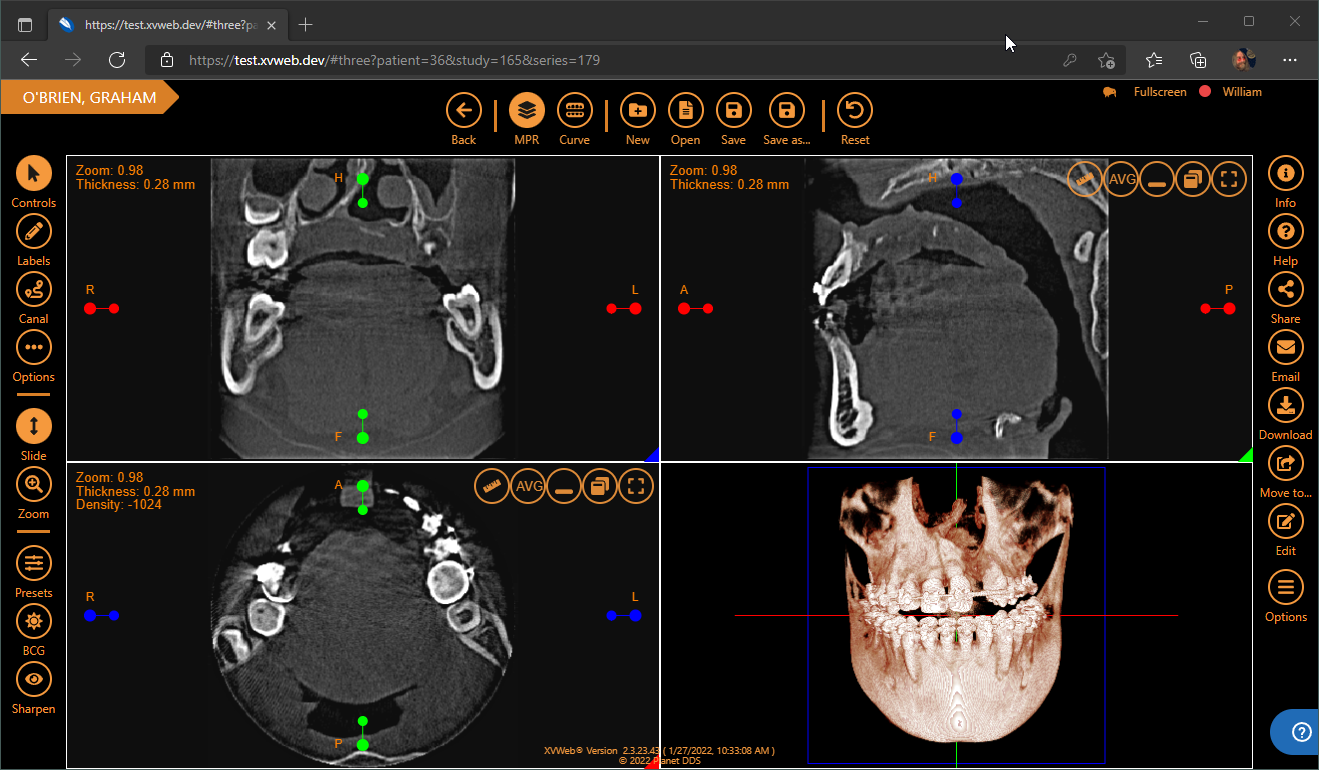screenshot of Apteryx XVWeb